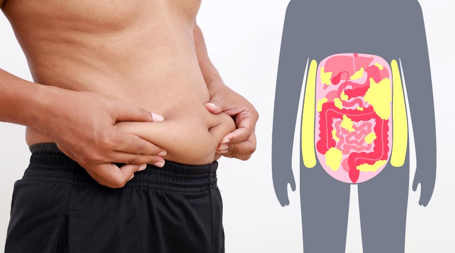 Différences entre le gras abdominal et le gras viscéral : mieux comprendre pour mieux protéger sa santé
