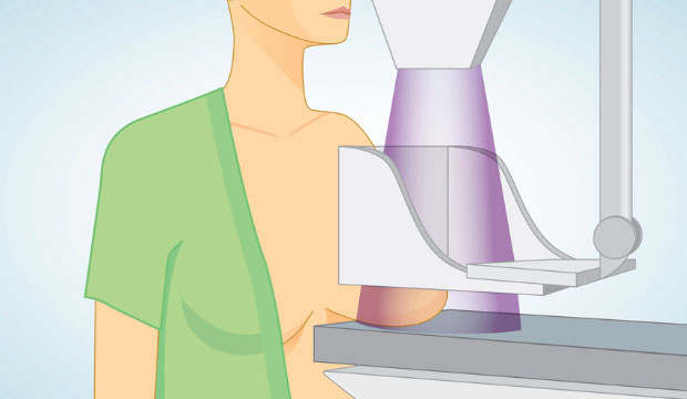 La mammographie, meilleure méthode pour dépister le cancer du sein