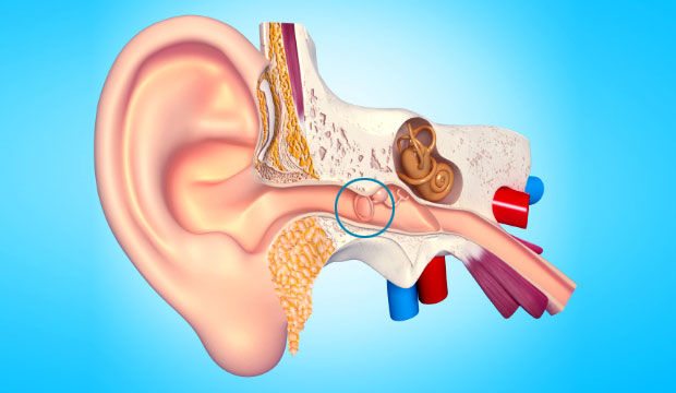 Dommages auditifs causés par le bruit